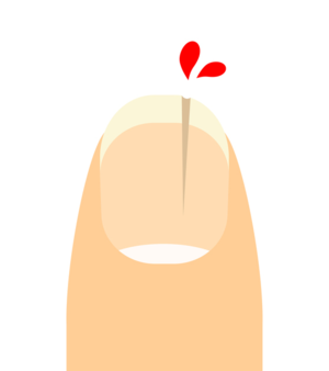 thumbimg